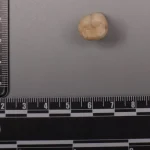 Эволюция человека: Homo erectus и ДНК Денисовцев
